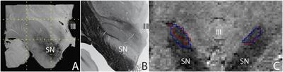 Do We Need a Human post mortem Whole-Brain Anatomical Ground Truth in in vivo Magnetic Resonance Imaging?